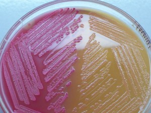 Escherichia coli O157: H7